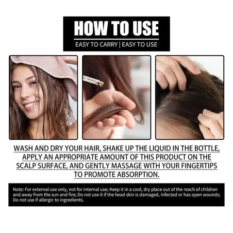 FORT Minoxidil Hair Growth Spray