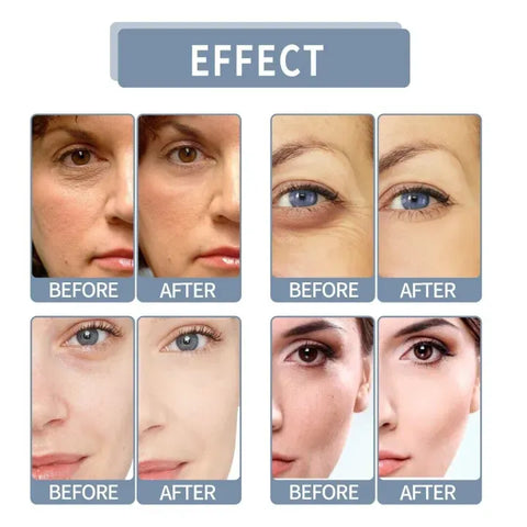 Serum Formula for Clear and Glowing Skin