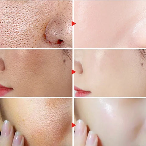 Serum Formula for Clear and Glowing Skin